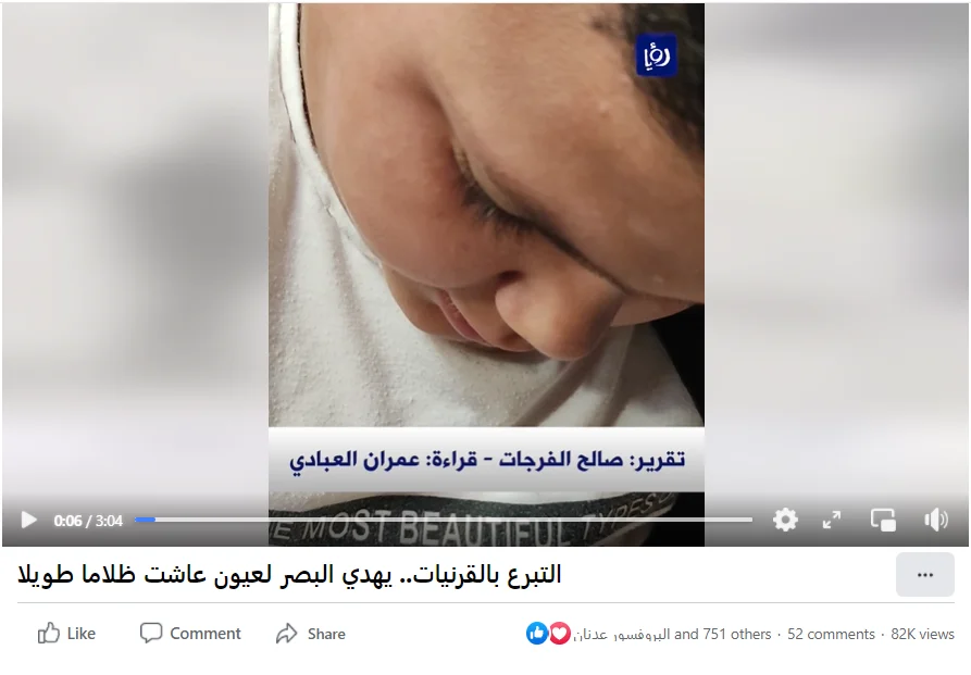 التبرع بالقرنيات.. يهدي البصر لعيون عاشت ظلاما طويلا